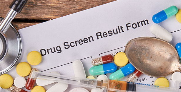 image of drug testing tools